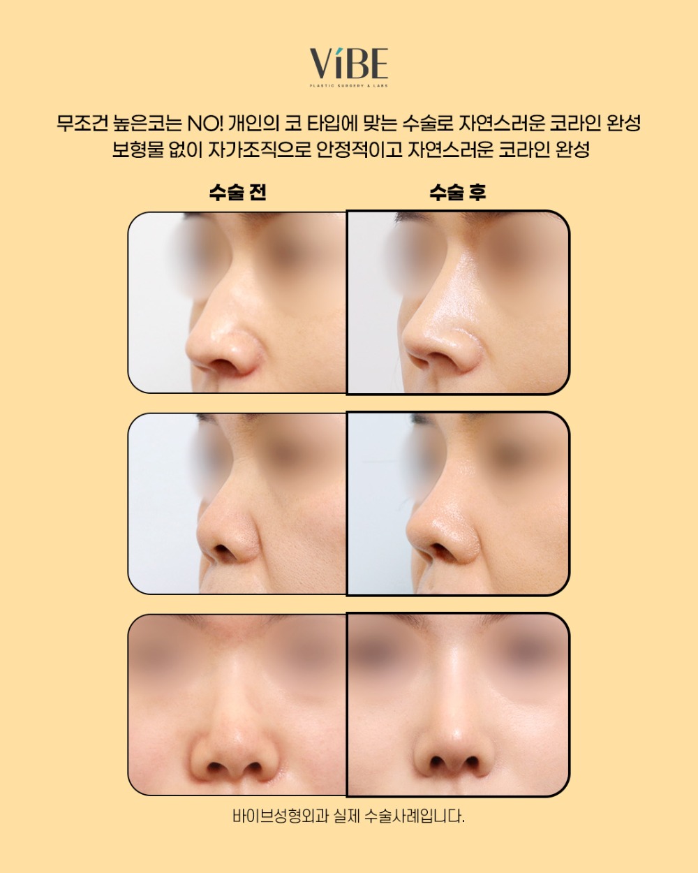 2026 수능 이벤트_카드뉴스4_코성형-2.jpg