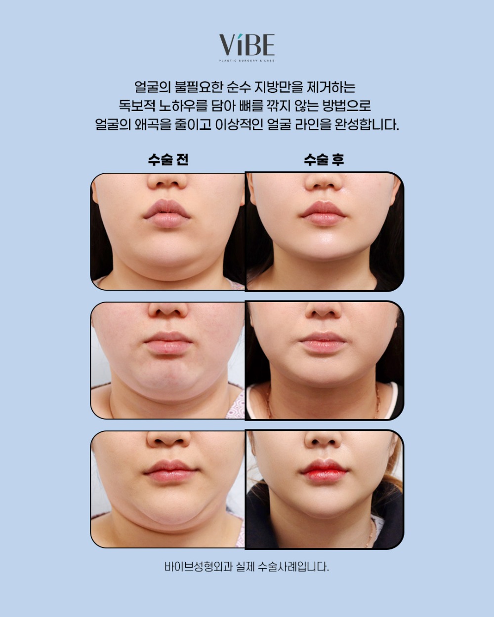 2026 수능 이벤트_카드뉴스5_얼굴지흡-2.jpg