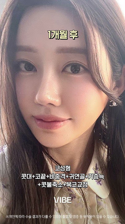 코성형(콧대+코끝), 비중격, 귀연골, 기증늑, 콧볼축소, 복코교정