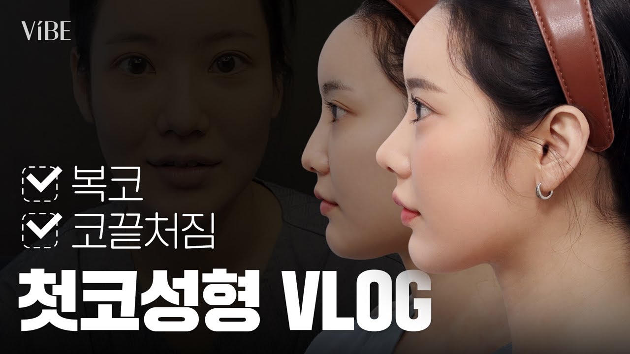 [성형 Vlog] 성형 티 안 나게 화려하지만 자연스러운 직반코 가능할까요?💬｜상담·수술·회복 4주 브이로그