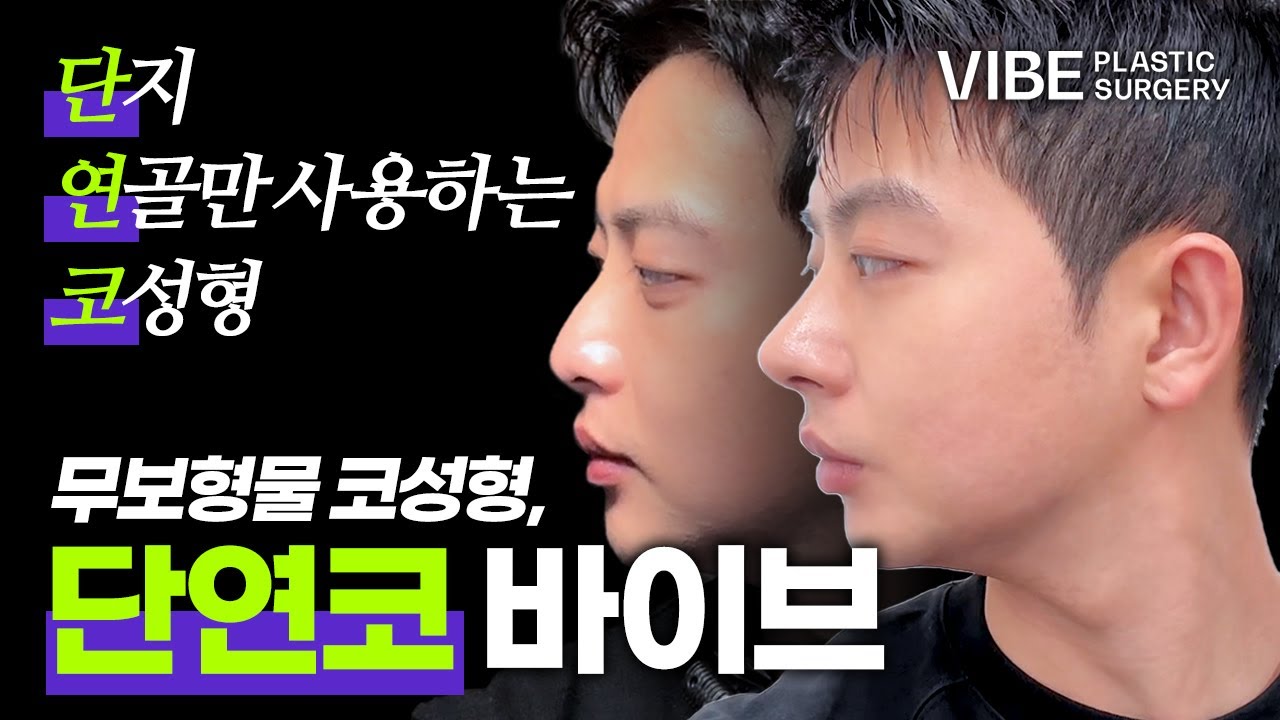 무보형물 코성형 단연코 바이브, 지창욱 VIBE 가능? | 남자 코수술, 이마축소 Q&A | 매부리코에서 직선코로! | 연골만 사용하는 코수술