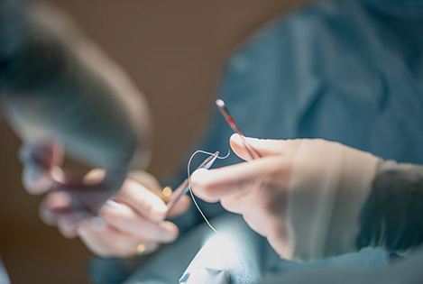 흉터 부담을 고려한 접근