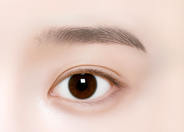 눈썹하거상 수술 방법 step 04 동안 눈매 완성