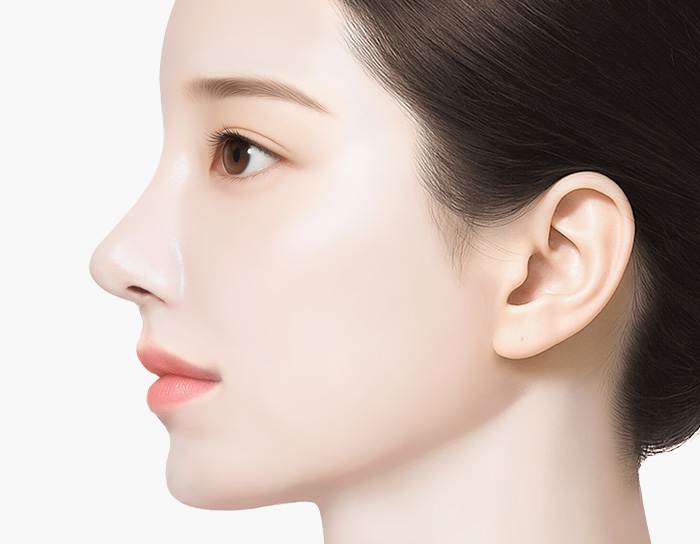 실리프팅 수술 방법 step 04 마무리