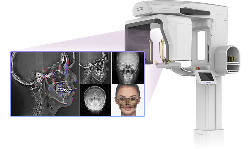 바이브 3D-CT 정밀분석