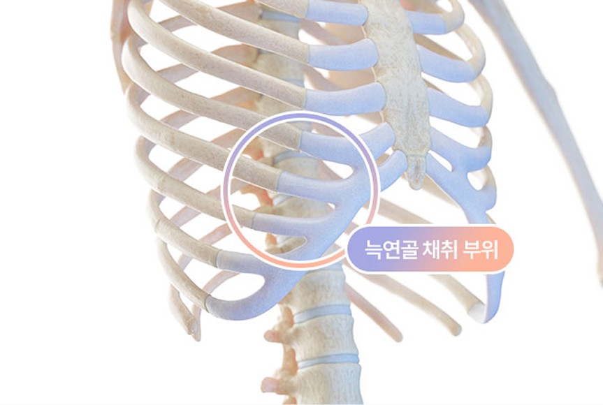 늑연골이란?