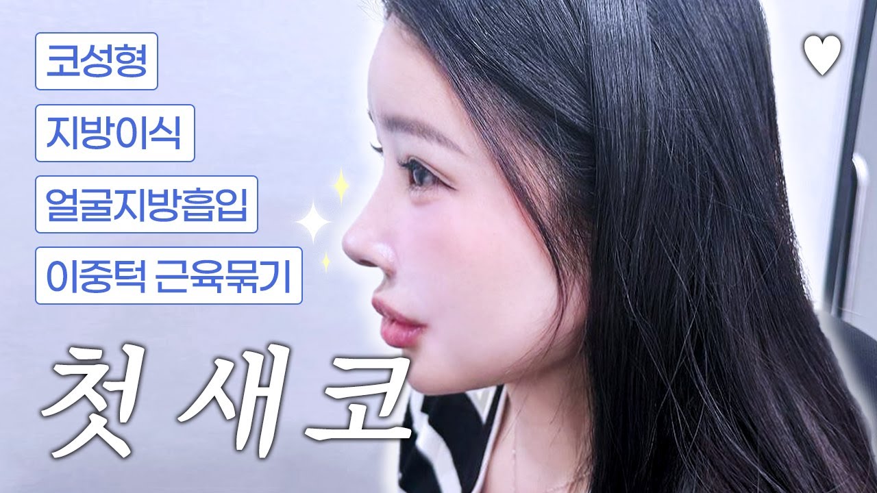 [VLOG] NEW 첫 코수술! 수술 당일부터 붓기 빠지는 가짜코 생성 과정 👃🏻🌟
