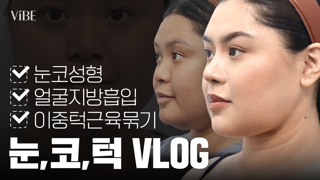 [성형 Vlog] 해외 환자가 다시 한국 온 이유? 성형 수술 2개월 후 변화