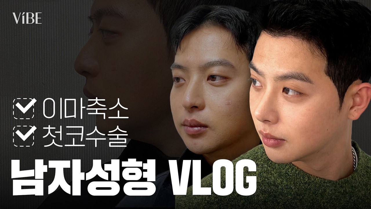 상담부터 전후비교까지📹 코성형, 이마축소 고민하는 남자분들 여기보세요