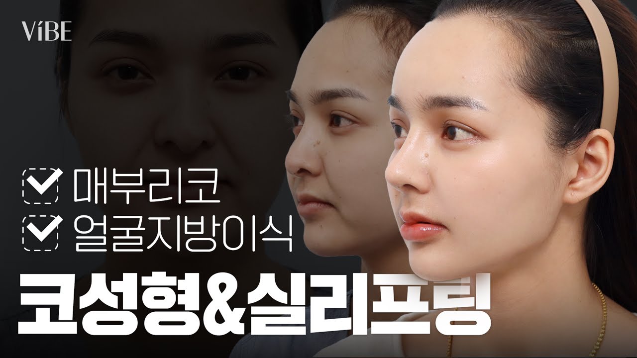[성형 Vlog] 태국에서 한국까지 온 이유! 풀패키지로 보여드립니다✨