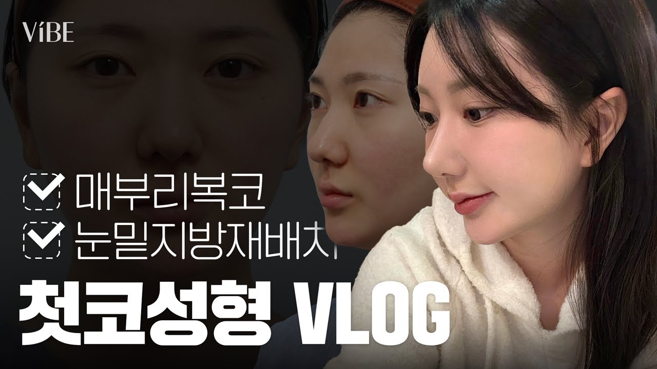 첫코성형 VLOG