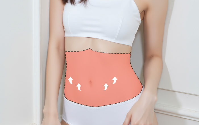 복부거상