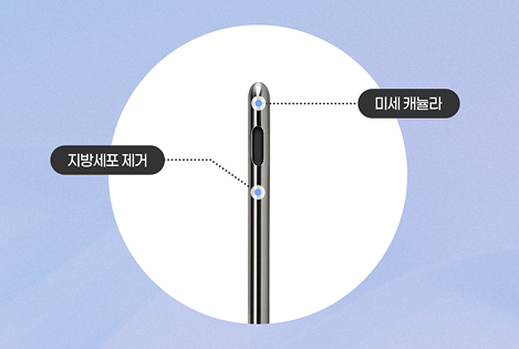 미세 캐뉼라 균일 흡입