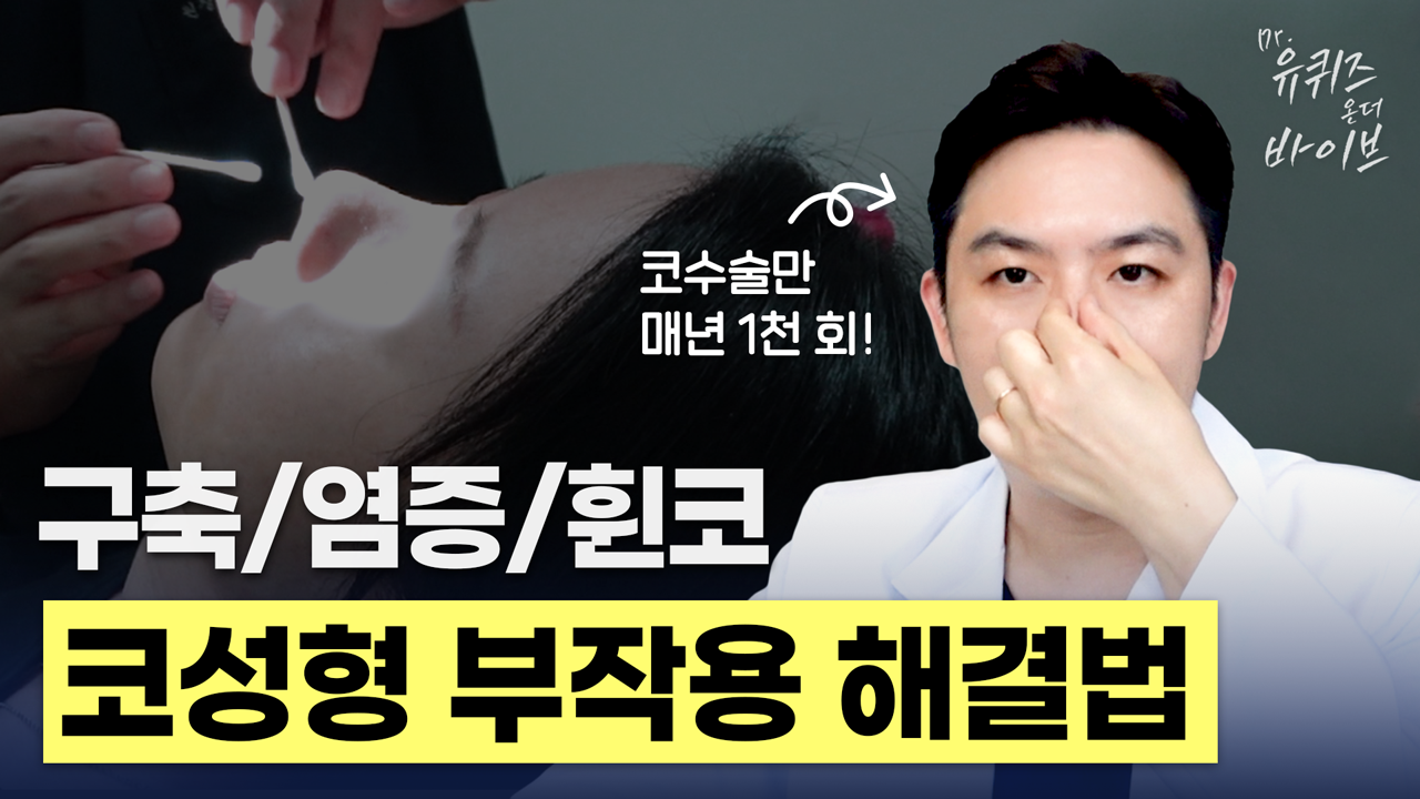 코성형 부작용 구축코 염증 휜코 재수술