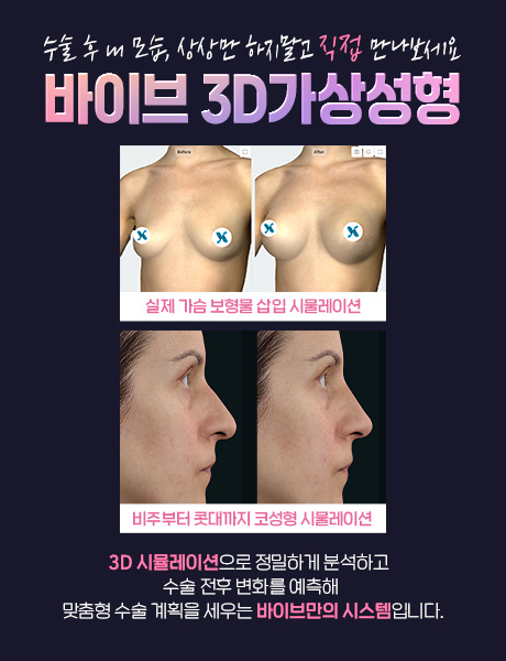 3D가상성형 팝업 버튼x