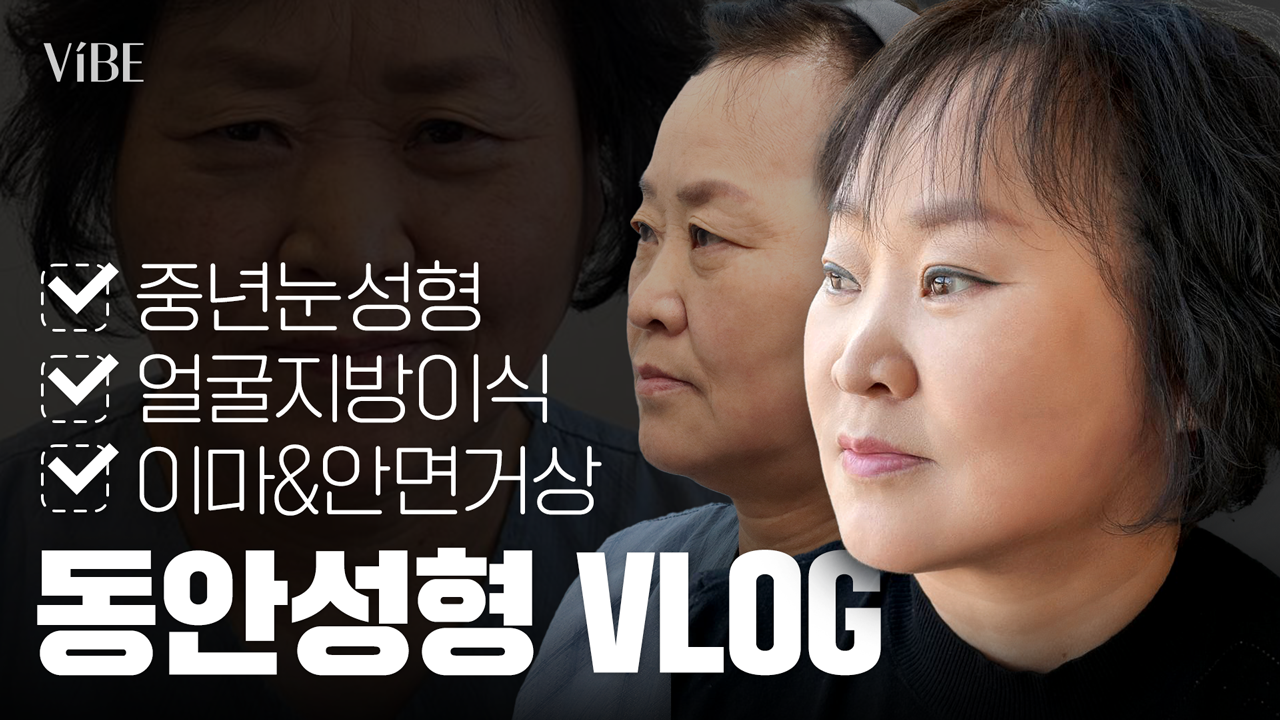 동안성형 중년눈성형 얼굴지방이식 이마 안면거상 바이브성형외과