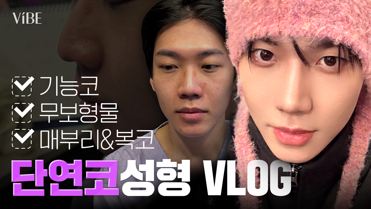 바이브 무보형물 단연코 코성형