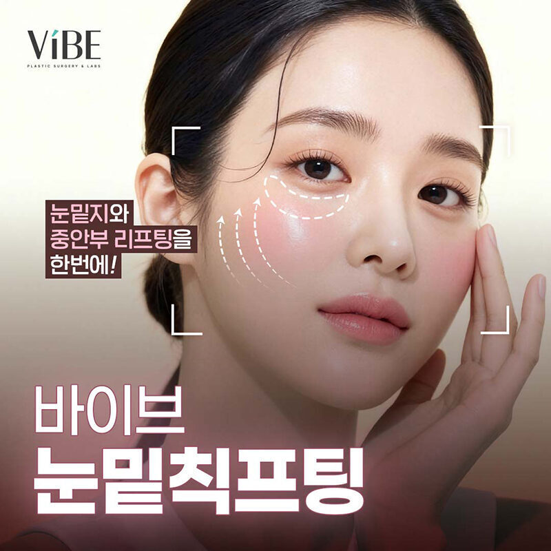 바이브 눈밑칙프팅 이벤트
