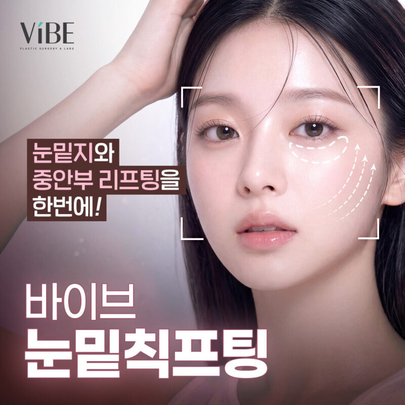 바이브 눈밑칙프팅 이벤트